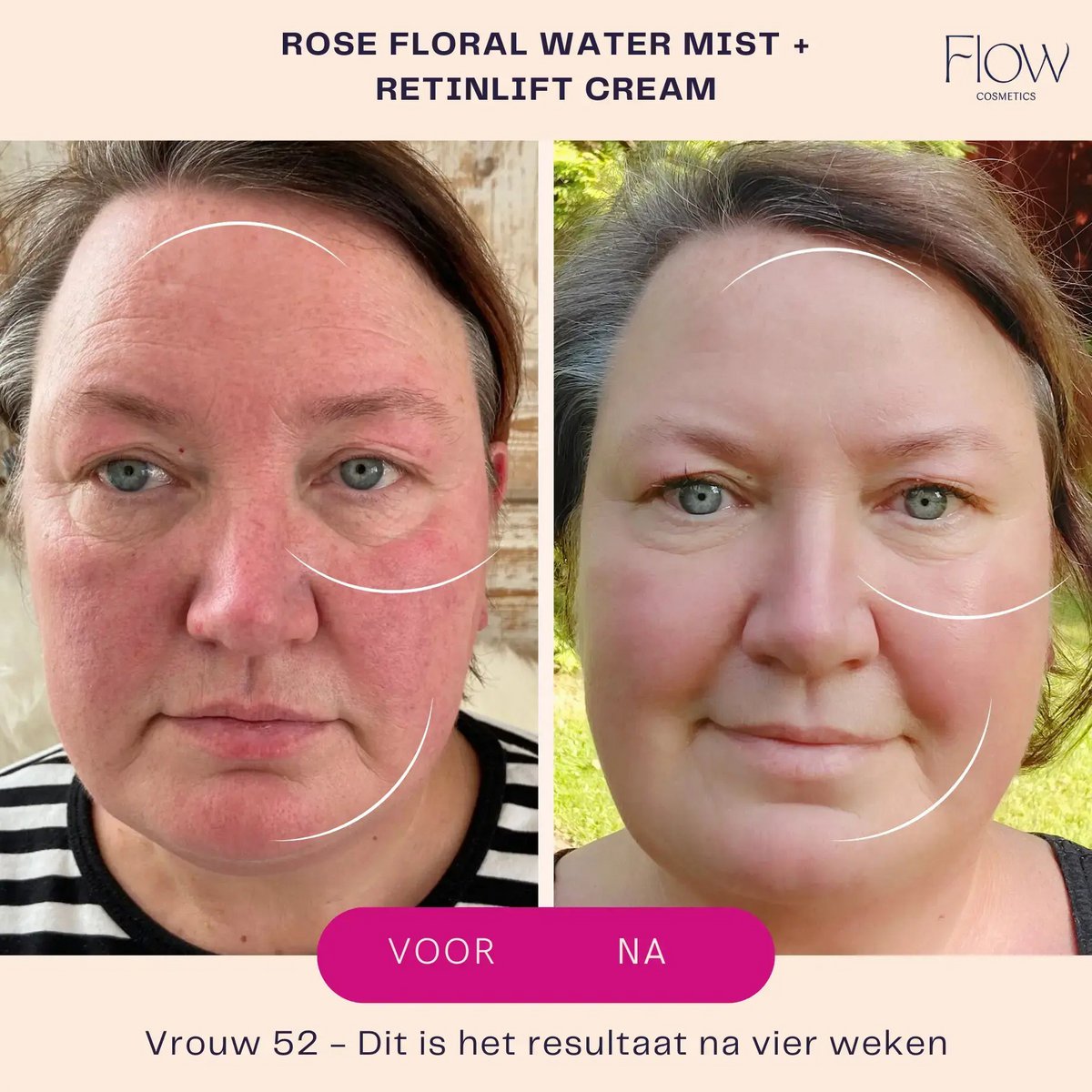 RetinLift 3-in-1 - Retinol Creme Mini