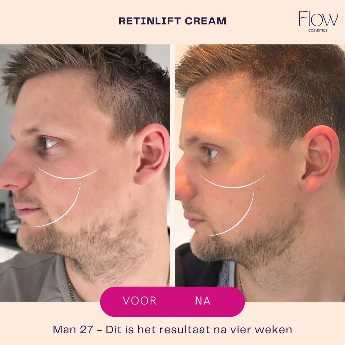 RetinLift 3-in-1 - Retinol Creme Mini