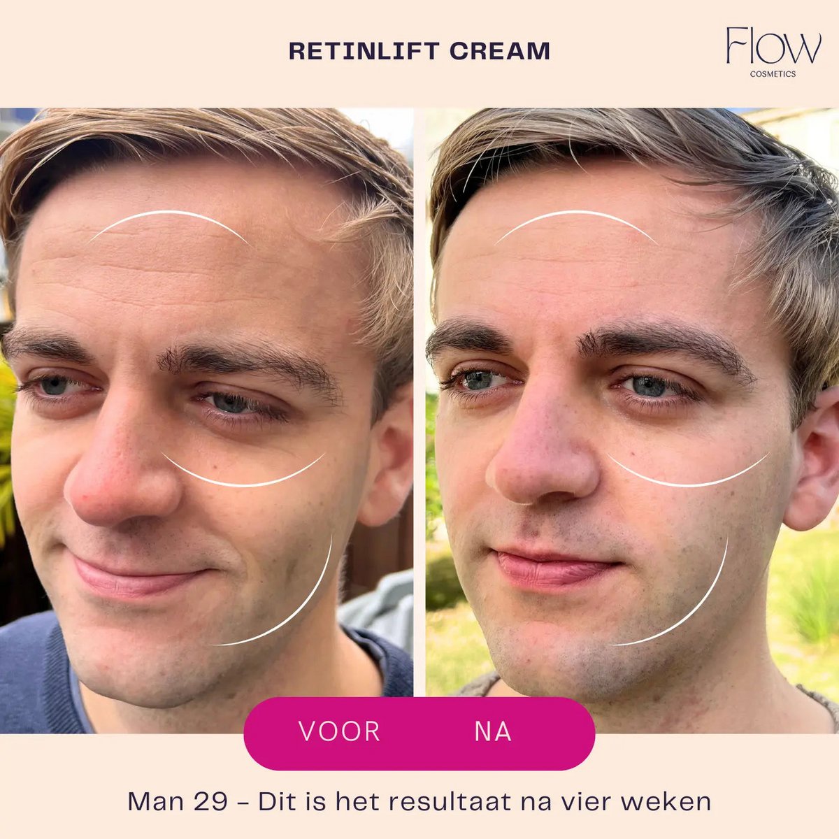 RetinLift 3-in-1 - Retinol Creme Mini